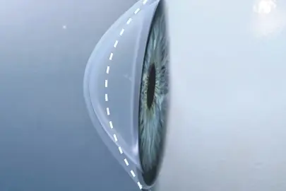 Sık sık gözünü ovuşturanlar dikkat!