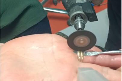 Batman'da parmağa sıkışan yüzüğe itfaiye müdahalesi