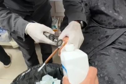 Batman'da kadının parmağına sıkışan yüzük çıkarıldı