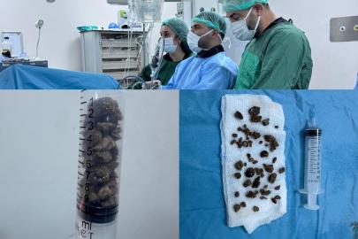 Bingöl'de böbrek taşı ameliyatlarında kapalı dönem: İl dışına sevkler azaldı