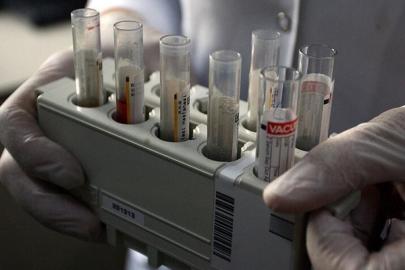 DSÖ'den "küresel hepatit" uyarısı