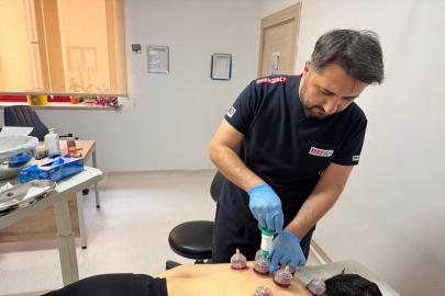 Hacamat ve akupunktur Diyarbakır’da hekim kontrolünde uygulanıyor