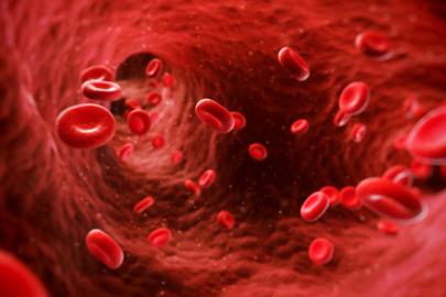 Hemofili hastalarına yönelik destekler sürüyor