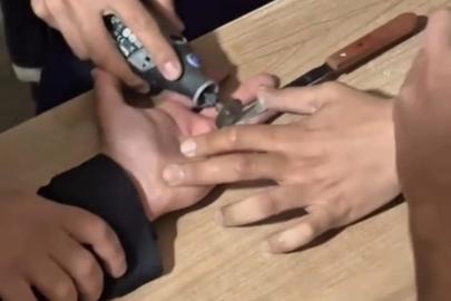 Parmağına sıkışan yüzük itfaiye ekiplerince çıkarıldı