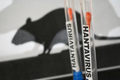 Sağlık Bakanlığından hantavirüs açıklaması: 3 vatandaşımız ülkemize getirilecek