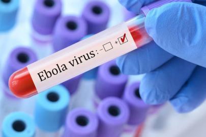 ABD'den Ebola önlemi: Kongo Demokratik Cumhuriyeti'nden dönüşlere geçici kısıtlama